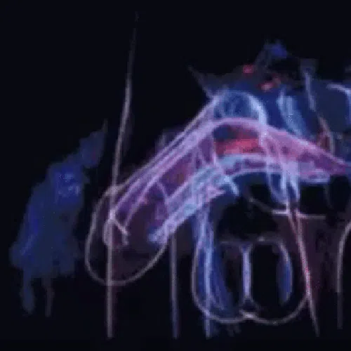 teaser